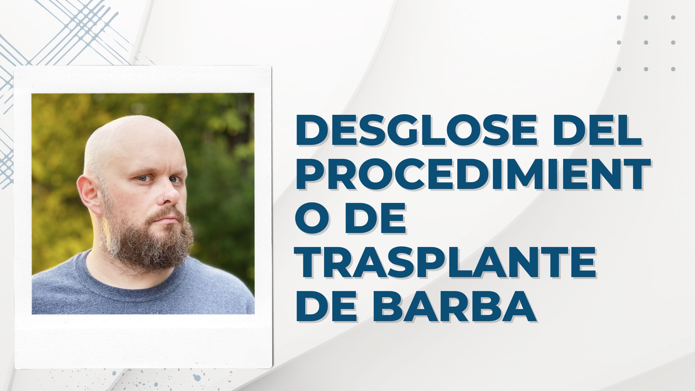 Desglose del procedimiento de trasplante de barba