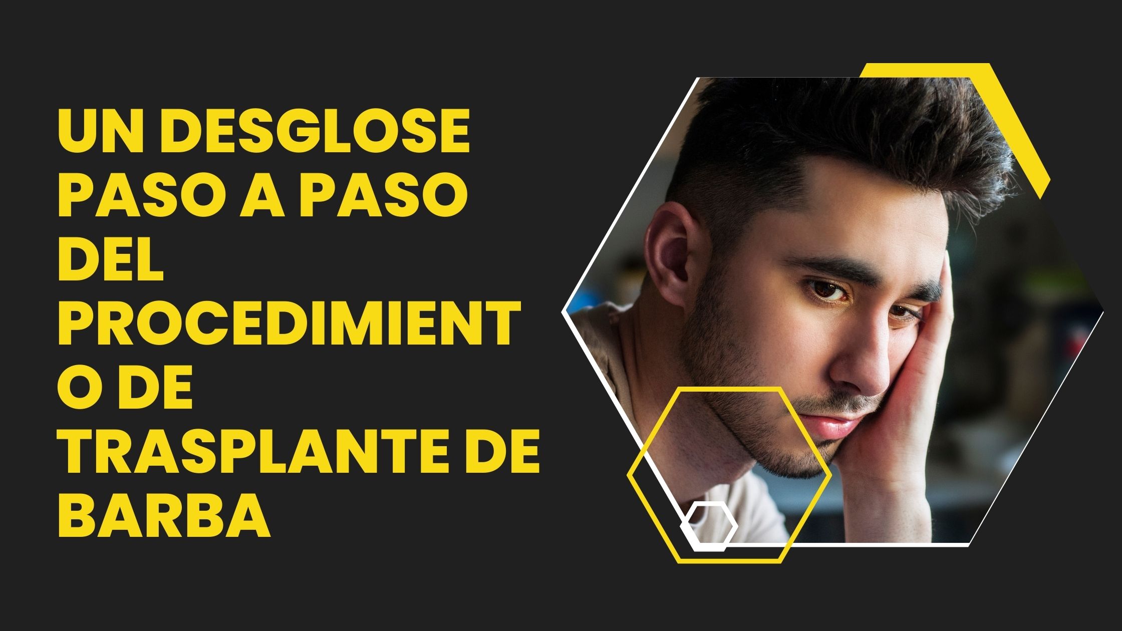 trasplante de barba antes y después