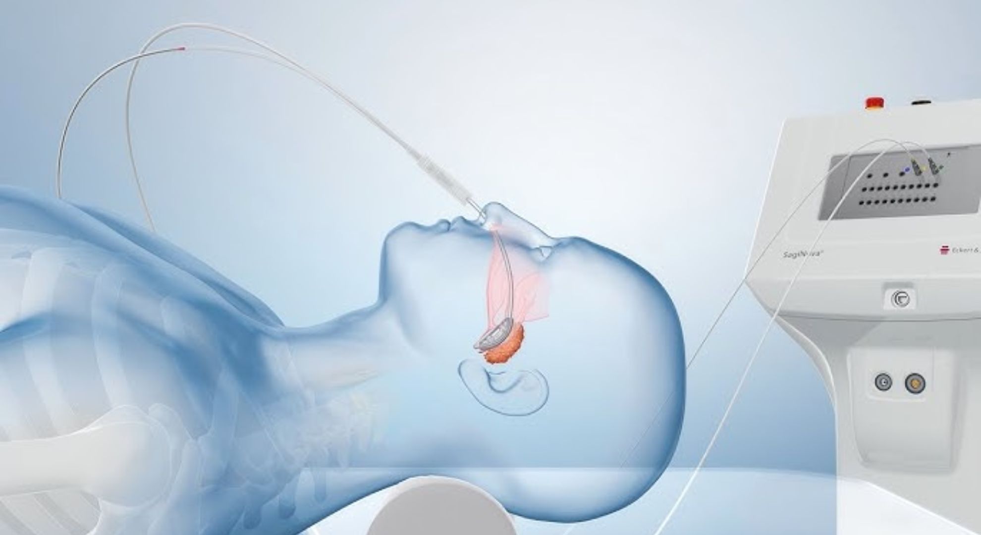 cancer treatment image