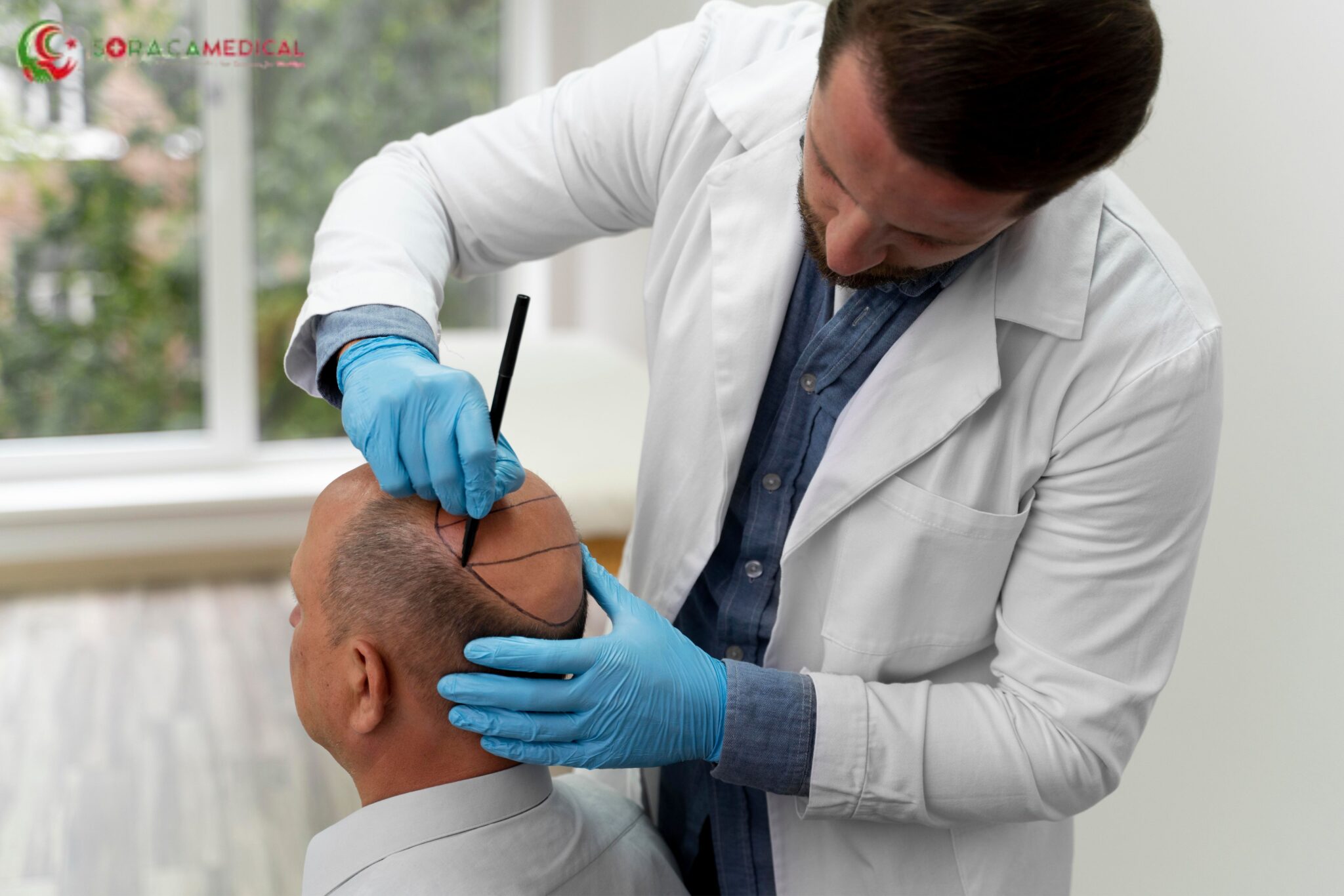 How Affordable and Effective is Hair Transplant in Turkey? Insights from Experts