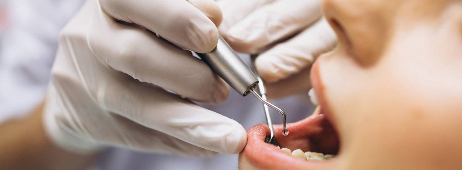 Choosing the Best Dentist in Dumfries: Quality Care & Emergencies