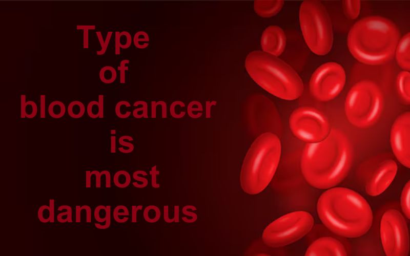 Blood cancer, also known as hematologic cancer, involves cancers that affect the blood, bone marrow, lymph