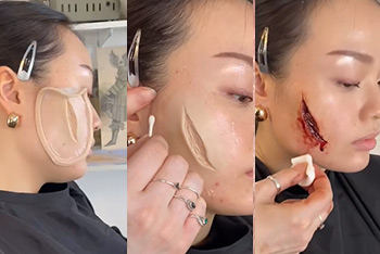 applying-prosthetics