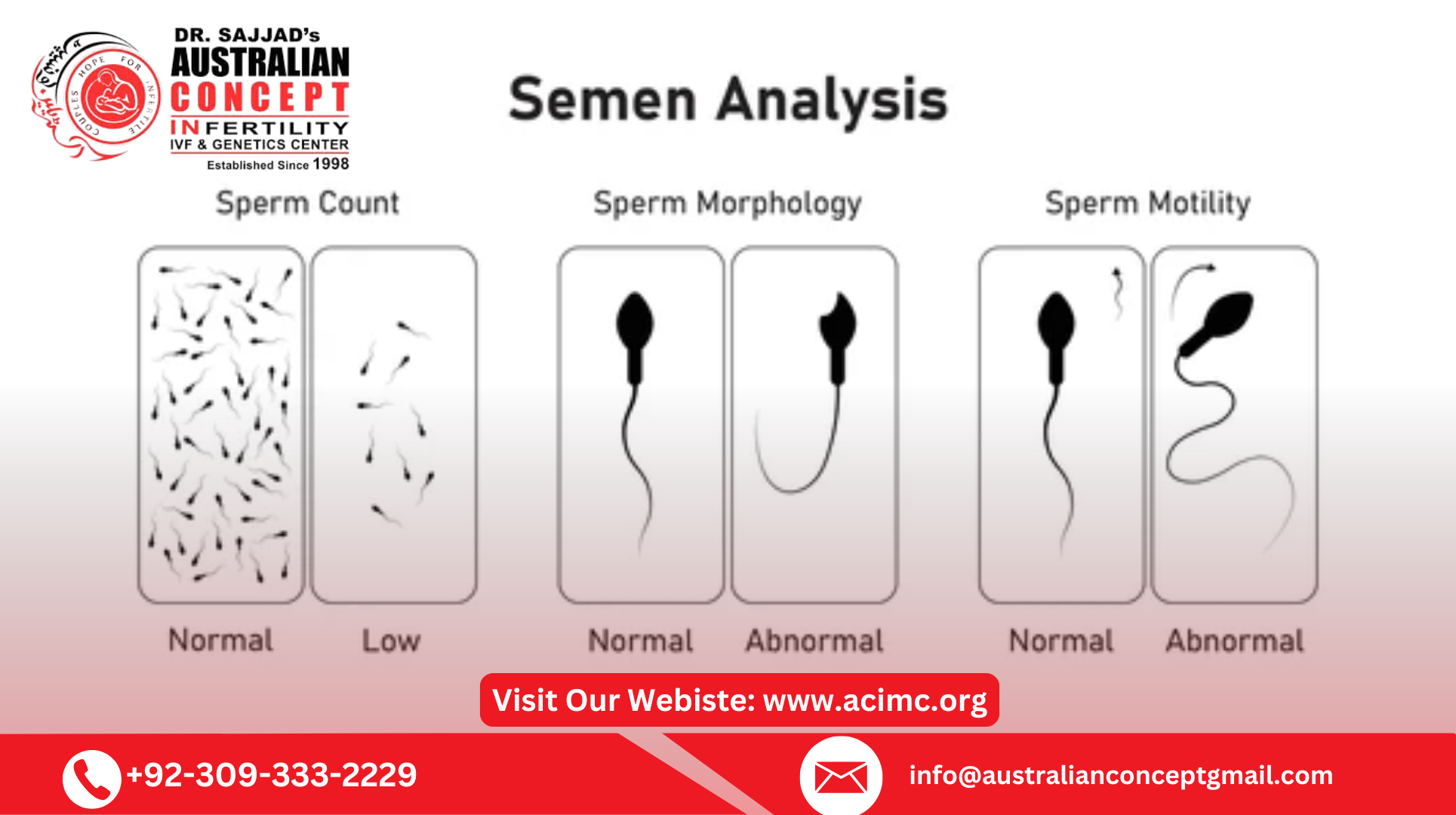 Azoospermia Treatment