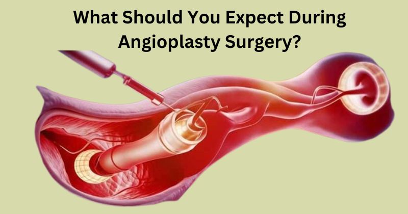Angioplasty surgery