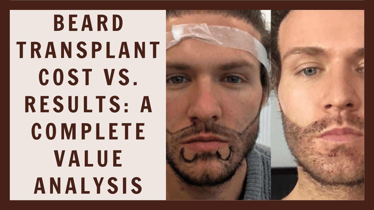 Beard transplant cost