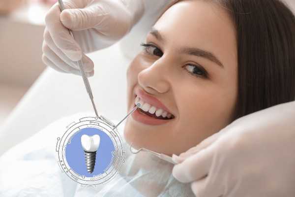 Dental Implant