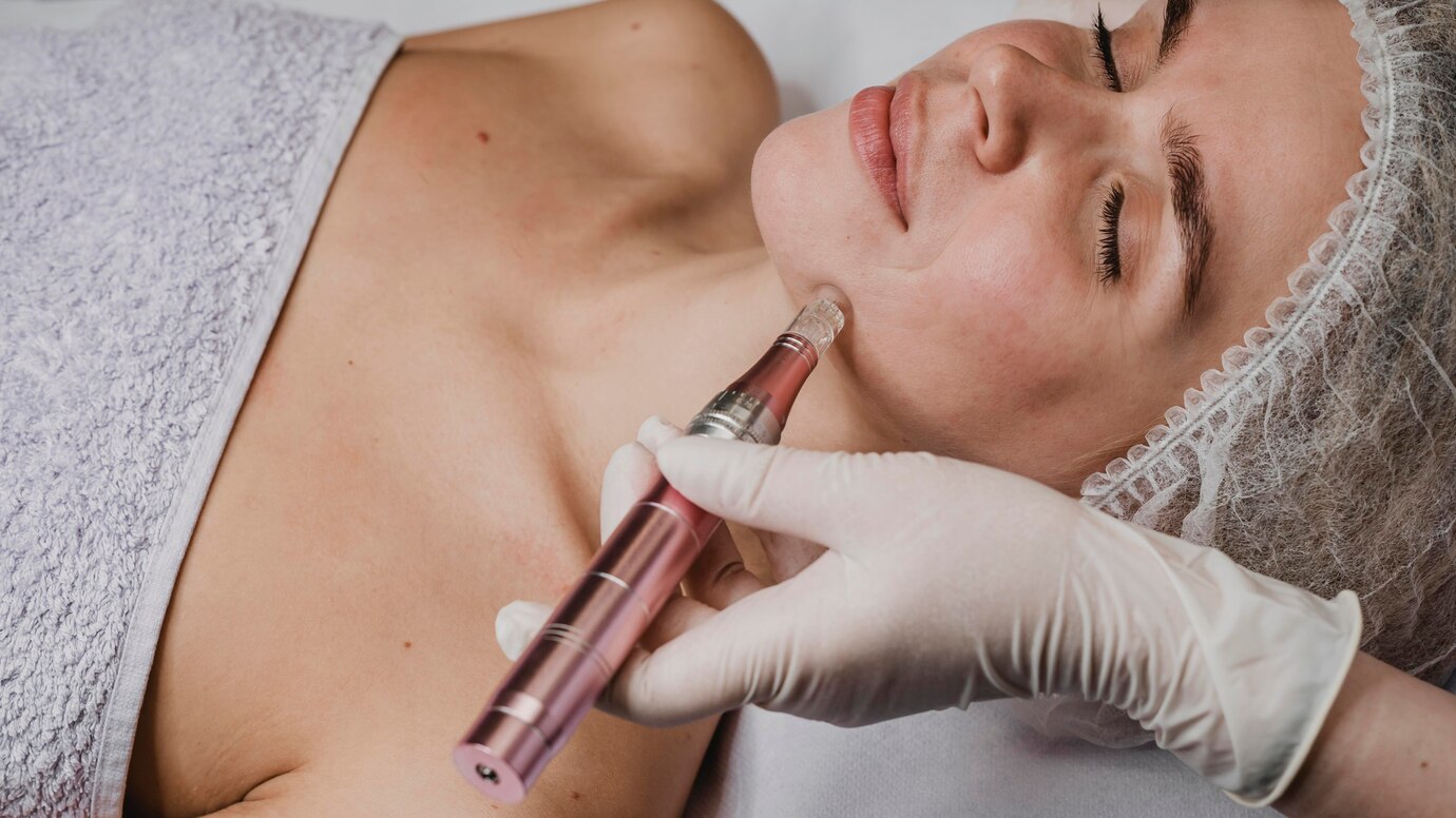 microneedling tucson