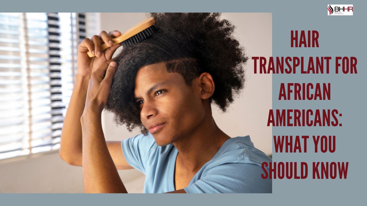 hair transplant for african american
