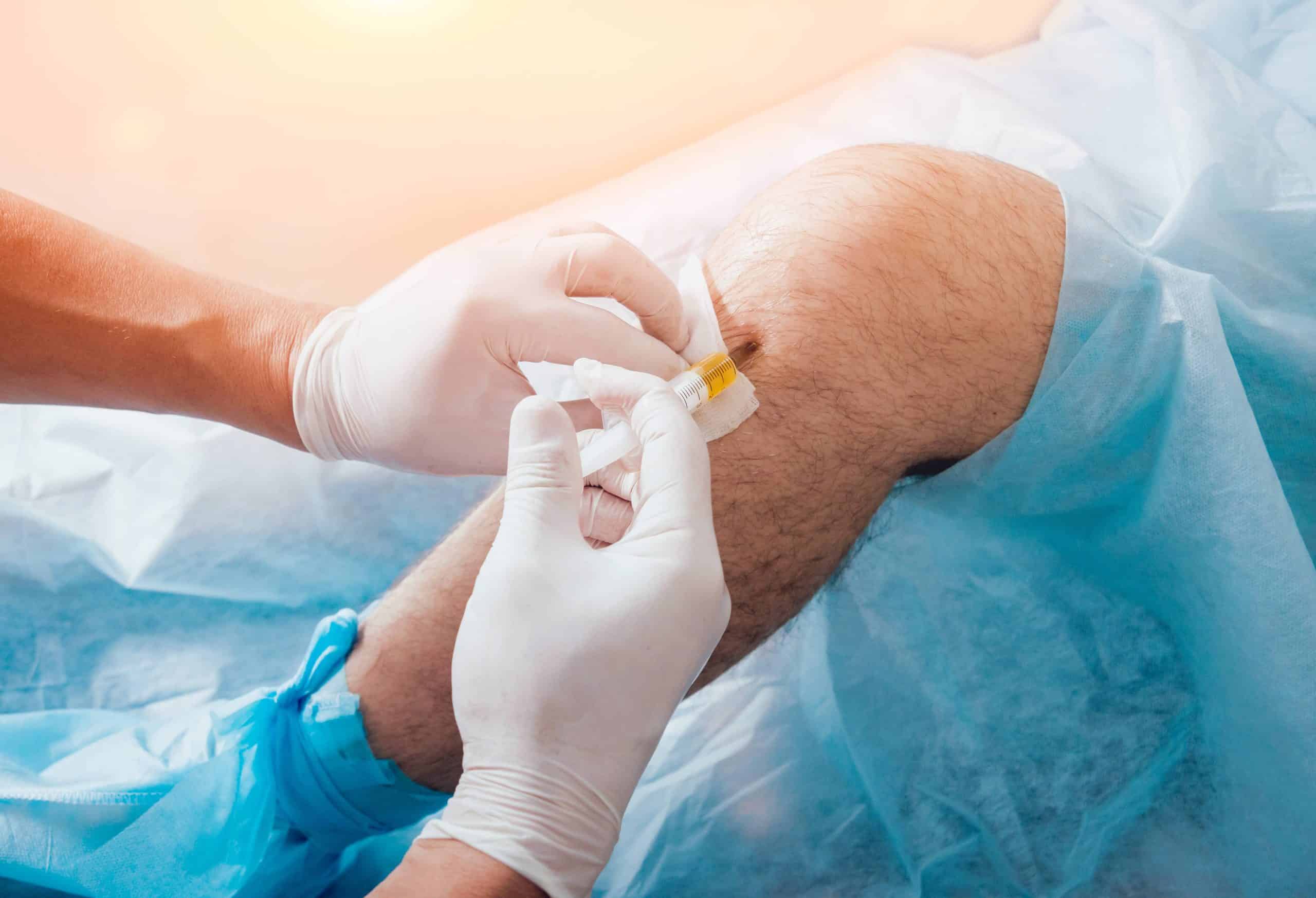 knee pain treatment manhattan