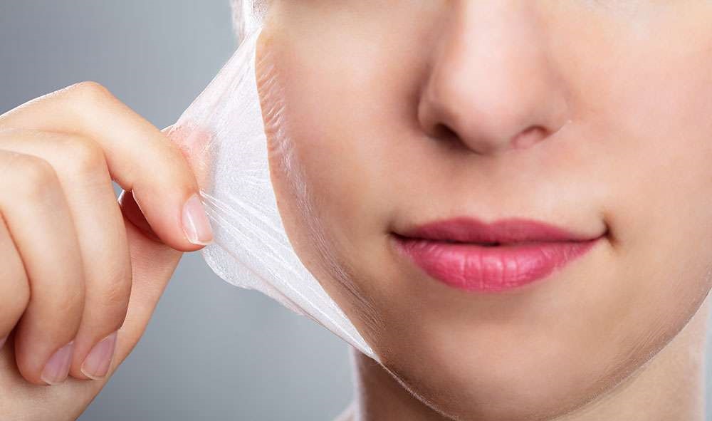 Combining Chemical Peels with Other Skin Therapies
