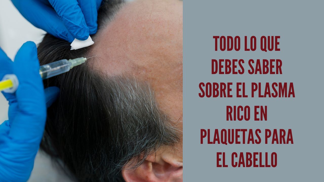 plasma rico en plaquetas para el cabello