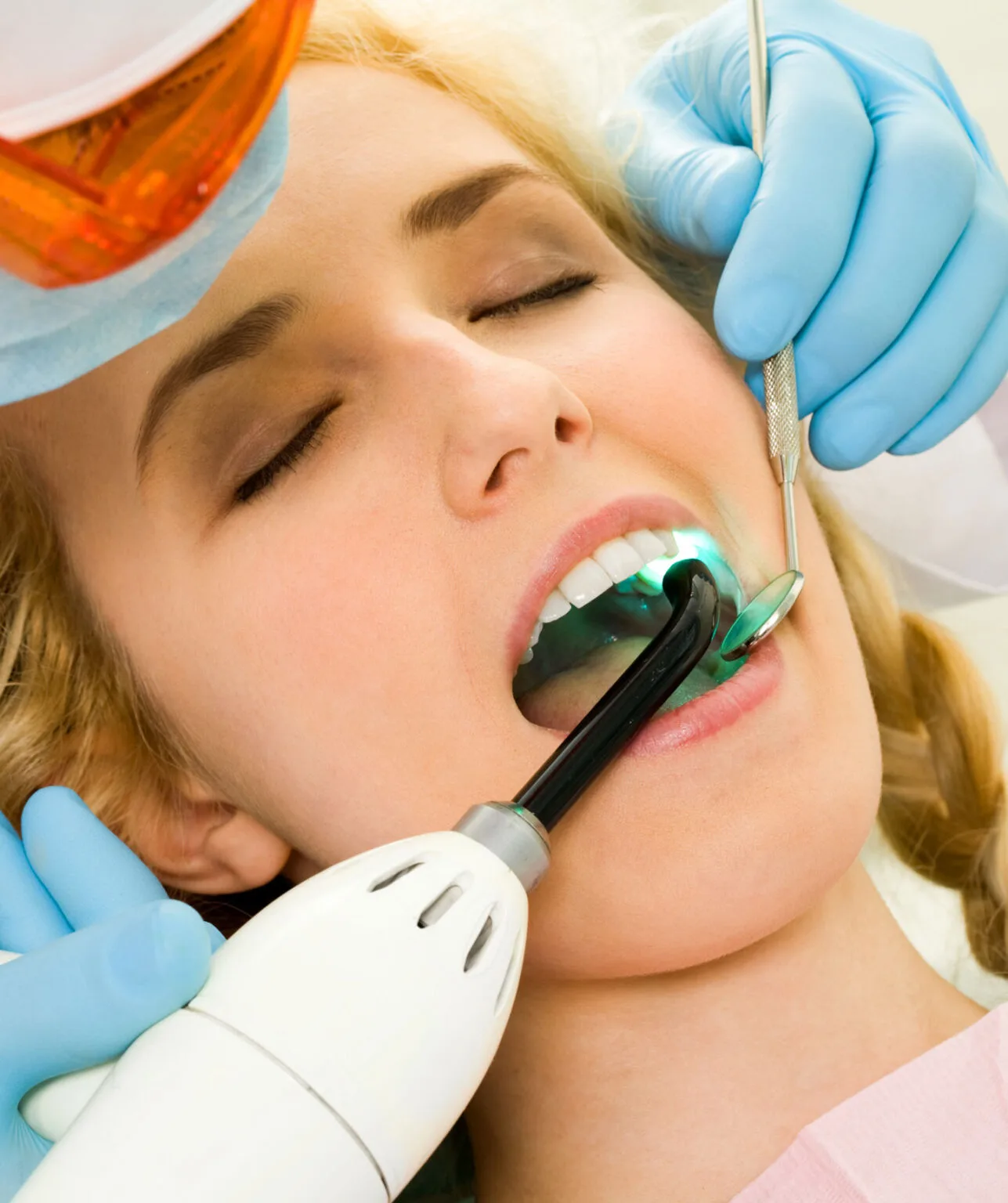 Are Composite Veneers Better Than Porcelain Veneers?