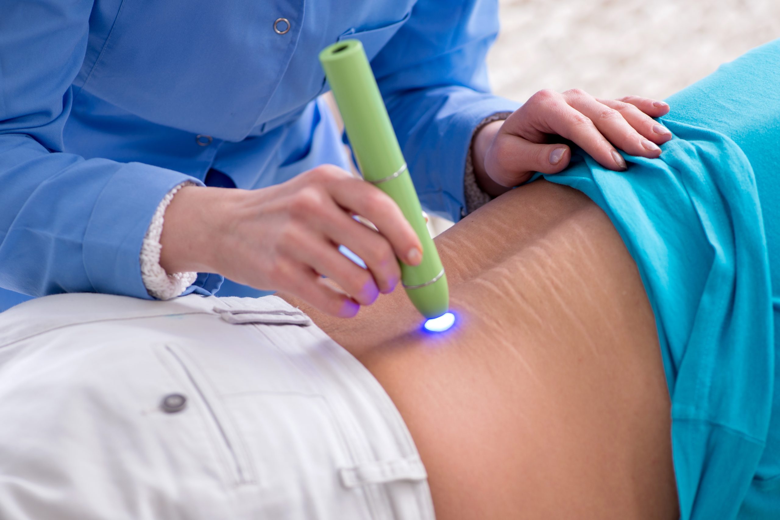 Scar Laser Treatment Boost Skin's Natural Glow