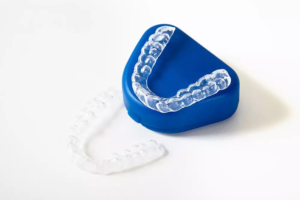 clear teeth straightening