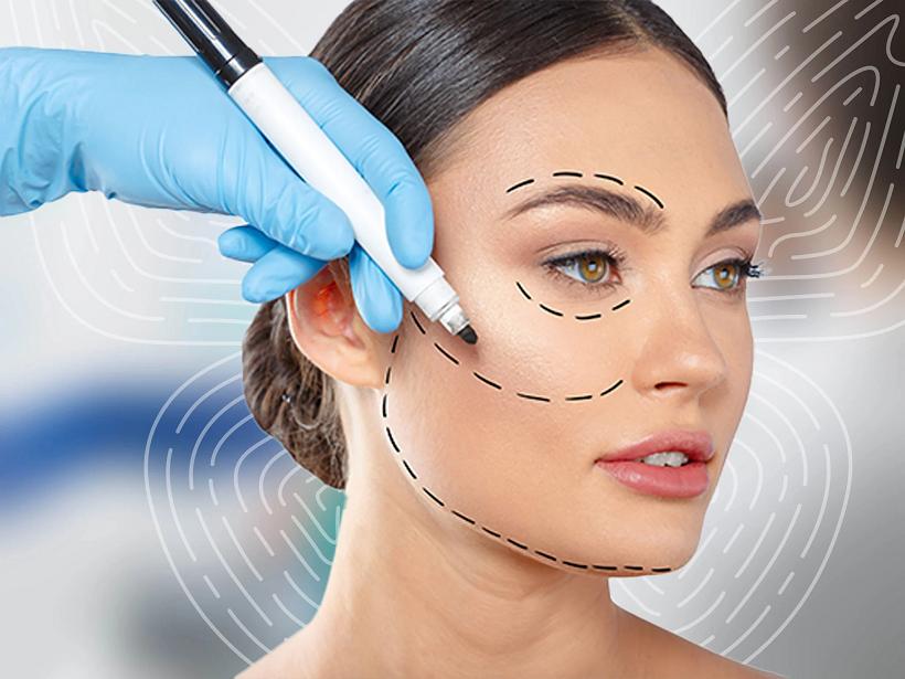 Facelift Surgery: Look Younger with Confidence