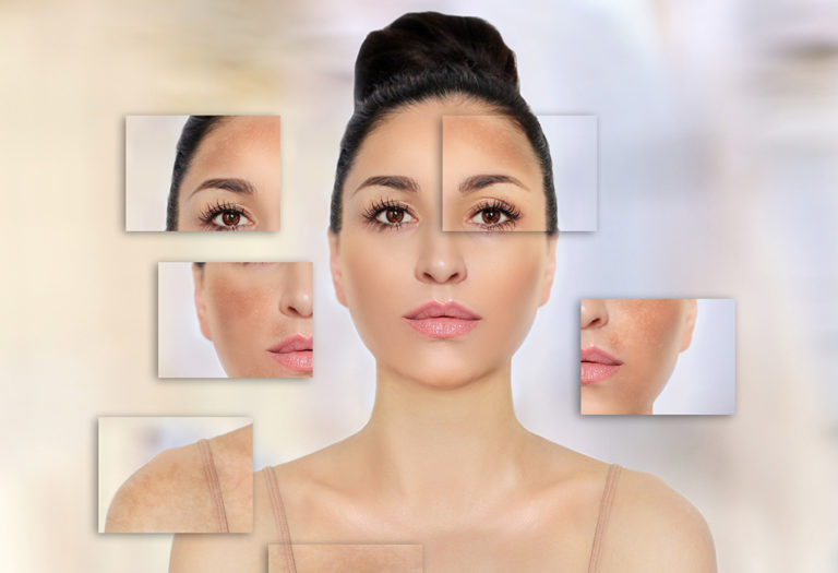 Pigmentation Treatment Best Solutions for Dark Spots and Freckles