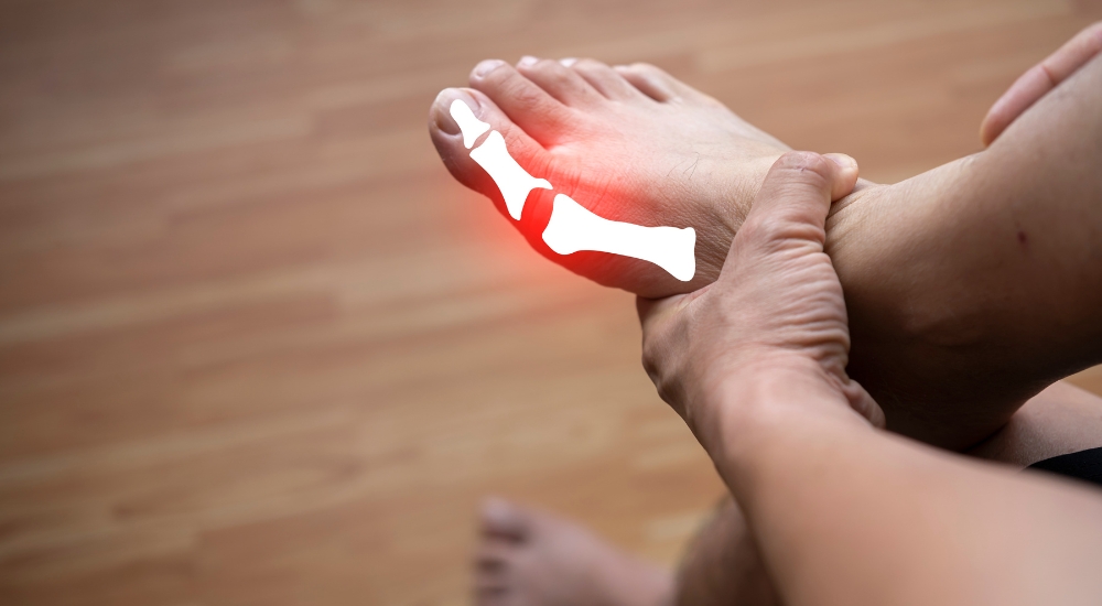 gout treatment in surat gujarat