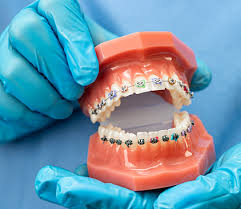 best dental clinic in Gurgaon