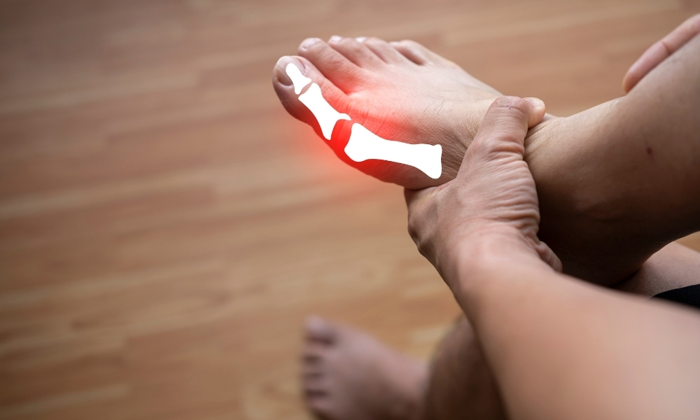 gout treatment doctor in surat