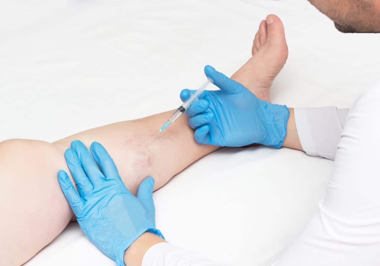 vein treatment center