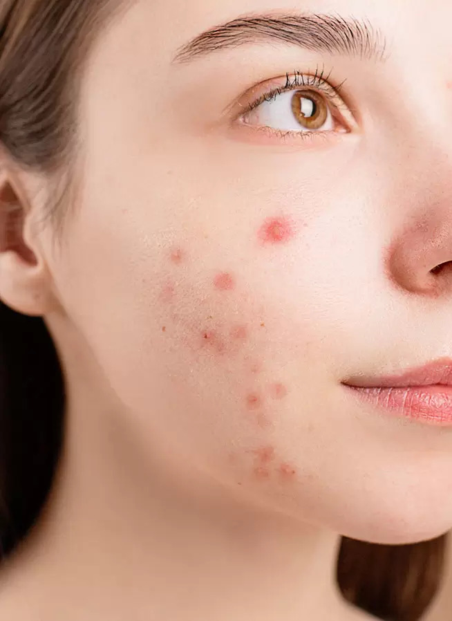 δερματικό εξάνθημα