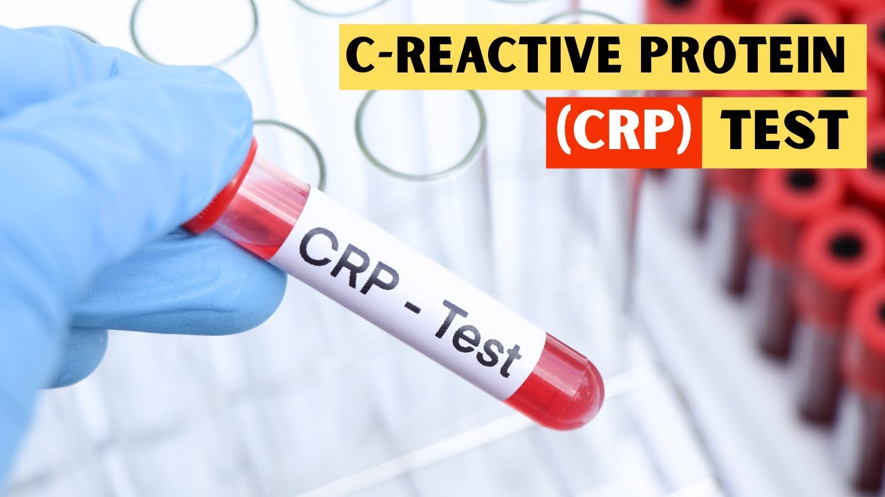 C-reactive Protein (CRP) Testing Market 