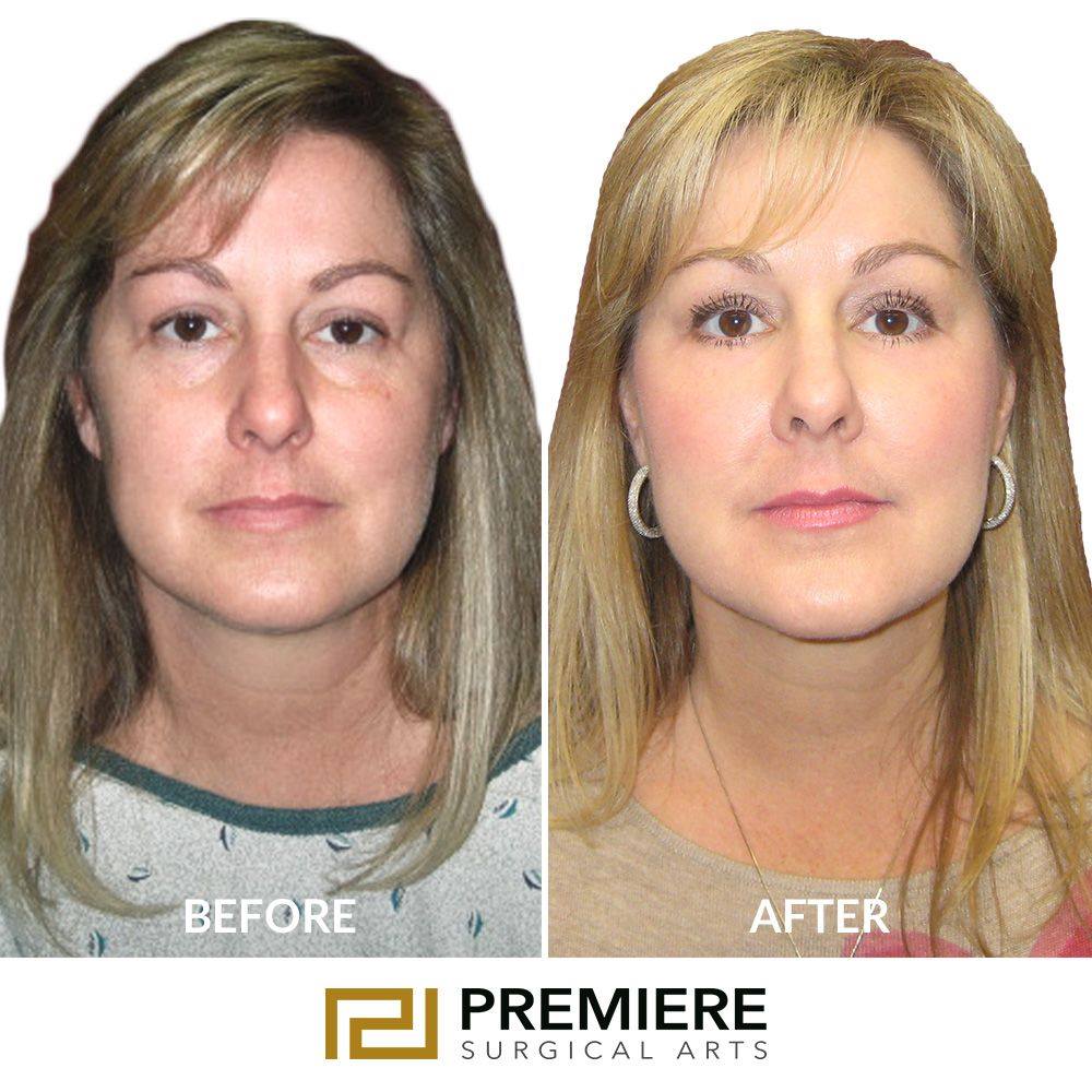 houston plastic and reconstructive surgery